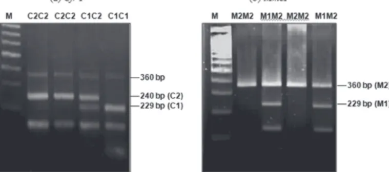 Figure 3 – DNA bands from PCR and polymorphism of HSP70 by PCR-RFLP, showing  PCR product size of 360 bp