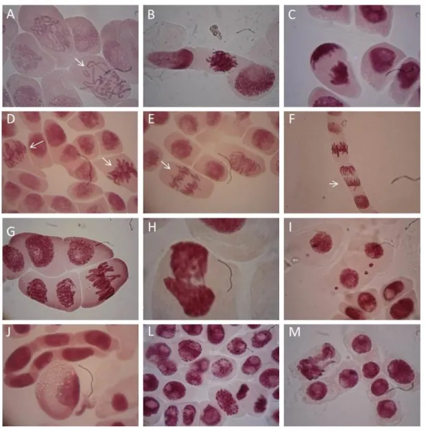 Figure 2.  Allium  cepa  meristematic  cells  exposed to  ethyl  methane  sulfonate  (EMS) (M)  and water samples collected at different sites (A-L); (A) c-metaphases (arrow); (B-C) sticky  chromosomes; (D-E) spindle abnormalities (arrow); (F) vagrant chro