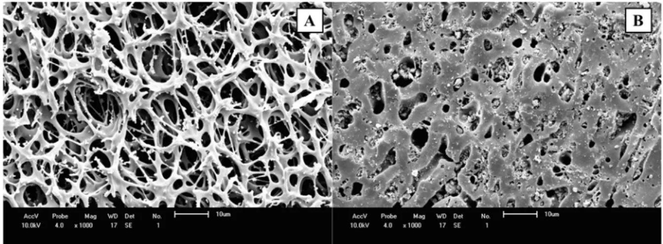 Figure  3  presents  the  result  of  TEM  analysis  of  GAC  impregnated  with  copper  oxide  nanoparticles