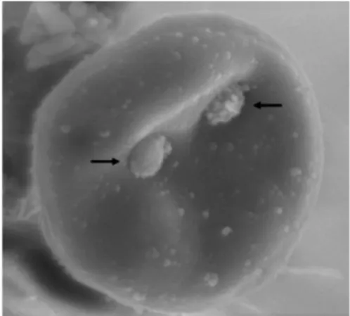Figura  25  -  Fotomicrografia  eletrónica  de eritrócito com dois organismos de M. 