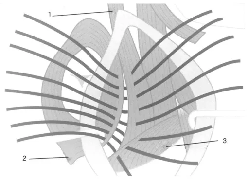 Figura 7 - Esquema da pré-colocação dos pontos de sutura na herniorrafia clássica (adaptado de Gomez et al., 2005)