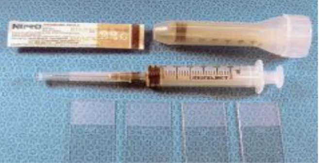 Figure  10.  Material  necessary  to perform  the  fine needle aspiration technique: 6 ml syringe,  22G needle and slides