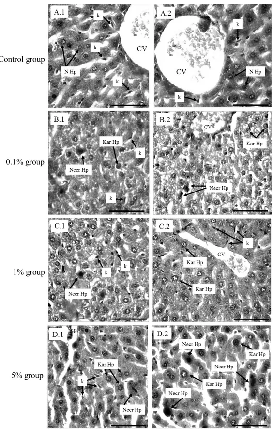 Figure 2. Photomicrographs representing distinct liver regions  (A.1 - D.2) of C57BL/6J mice exposed to intake of tannery effluents in  different concentrations diluted in filtered water