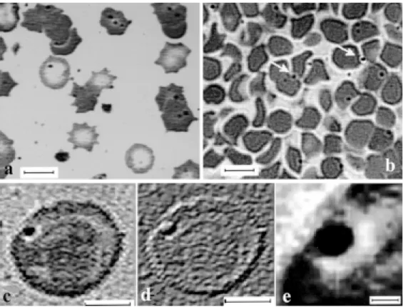 Fig. 2. Elect ron microscopic phot ographs showing a spherical st ruct ure corresponding t o M ycoplasma sui s (a)
