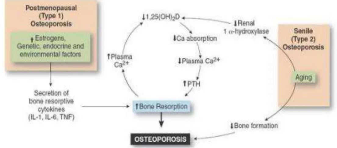 Figura 5: Ilustração esquemática da fisiopatologia da osteoporose [81]