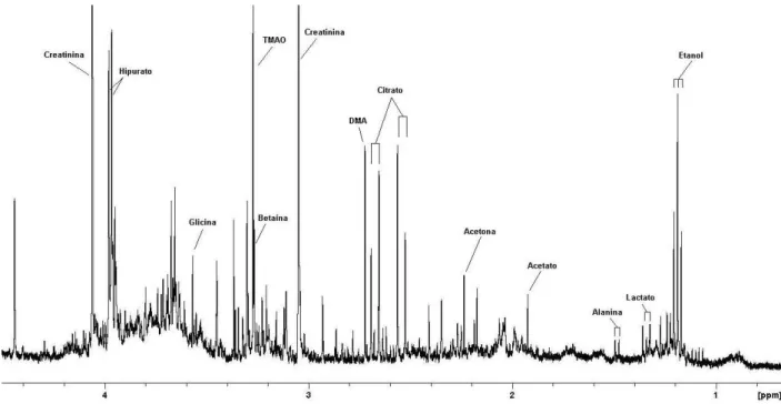 Figura 2.4. Espectro de RMN de  1 H típico de uma amostra de urina de humano  diagnosticado com DMT2.