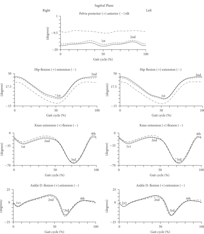Figure 2: Kinematic parameters (sagittal plane) of gait of pregnant women in the later stages of second trimester (dashed line) and third trimester (solid line) and of nulliparous controls (dot line)