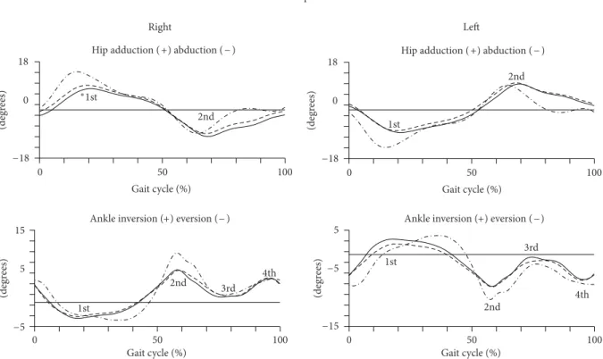 Figure 3: Kinematic parameters (frontal plane) of gait of pregnant women in the later stages of second trimester (dashed line) and third trimester (solid line) and of nulliparous controls (dot line)
