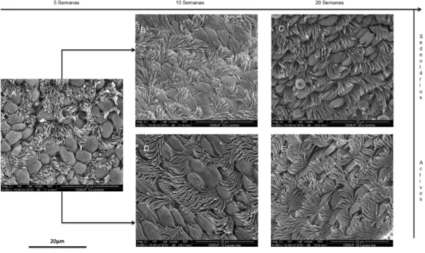 Figura  7  –  Fotografias  de  microscopia  eletrónica  de  varrimento  representativas  da  traqueia  de  animais dos grupos baseline (GB), sedentário (GS) e ativo (GA)