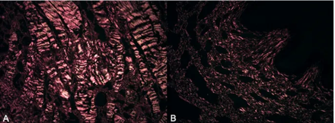Table 3. Volumetric density of smooth muscle cells in corpus  cavernosum and corpus spongiosum of the penis of cattle 
