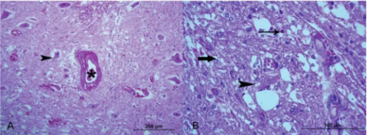 Table 2. Microscopical lesions in the CNS, liver and heart of pigs experimentally poisoned with intramuscular and oral  administration of sodium selenite