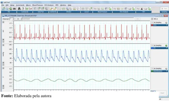 Figura 4. Ilustração da aquisição dos sinais de ECG, onda de pressão e sinal respiratório 