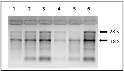 Figura  9-  Gel  desnaturante  de  agaroseà  1,2%.  Amostras  de  RNA  de  reticulócitos  de  pacientes  com  deficiência  de  glicose-6-fosfato  desidrogenase  e  pacientes  com  doença  falciforme  por  hemoglobina  SC,  onde  pode-se  ver  as  subunidad