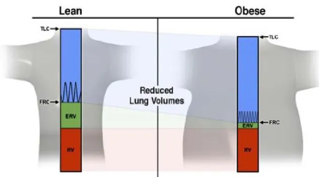 Figura 1 -  Comparação  das principais  alterações  dos  volumes  pulmonares  entre  o  sujeito eutrófico e obeso