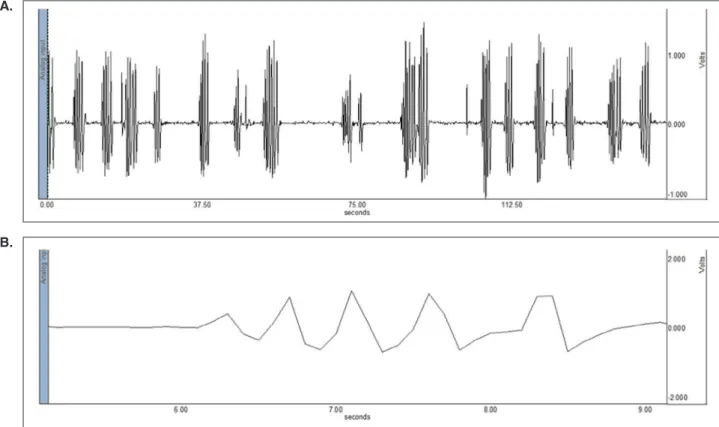 Figure 4. A. Non-nutritive sucking (NNS) pattern (multiple bursts). B. Second burst from Fig