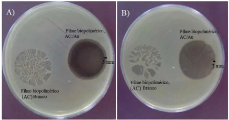 Figura 5. Atividade Antimicrobiana dos filmes biopoliméricos, AC (Branco,  filme sem NPs Au) e AC/Au (filme contendo NPs de Au) frente as Bactérias: 