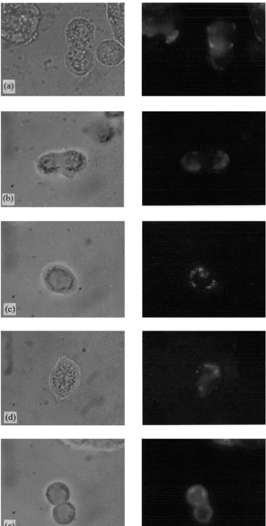 Fig. 5. Right panel: fluorescence images of HT 29 cells incubated (300 min.) with mTHPC (0.625 mg/ml) formulated in (a) PLA NCs; (b) NE; (c) polox PLA NCs; (d) PLA–PEG NCs; and (e) solution