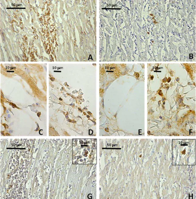 Figura  5  -  Fotomicrografias  de  cortes  histológicos,  submetidos  a  reações  imuno-histoquímicas  (CD4 + , CD8 + , CD14 +  e Neutrófilos), do átrio direito (AD) ou do septo interventricular (SI) de cães  infectados  por  formas  tripomastigotas  meta