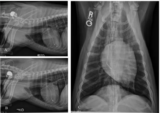 Figura 6 – Radiografias torácicas ilustrando a correta localização do elétrodo e gerador de um pacemaker após  implantação pela técnica transvascular