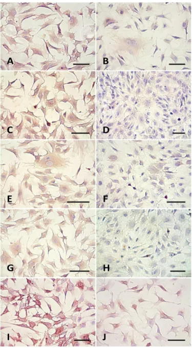 Figure 1 shows the results of the indirect immunopero- immunopero-xidase staining using monoclonal antibodies against  ICAM-1 (Fig.ICAM-1A), VCAM (Fig.ICAM-1C), PECAM-ICAM-1 (Fig.ICAM-1E), TSP (Fig.ICAM-1G),  and polyclonal antibody against E-selectin (Fig