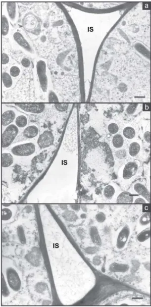 Figure 2. Transmission electron micrograph, showing inclusions of PHB in a nodule from cultivar EMGOPA-201 (a) watered, with peribacteroid membrane (PBM), PHB granules (Po) and from cultivar Carioca (b), after five days of water stress, showing rupture of 