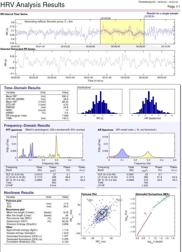 Figura  1.  Ilustração  da  tela  de  resultados  de  uma  voluntária  asmática,  da  variabilidade  da  frequência  cardíaca  obtida  pelo  software  Kubios  HRV  Analysis  (MATLAB, versão 2.1, Kuopio, Finland)