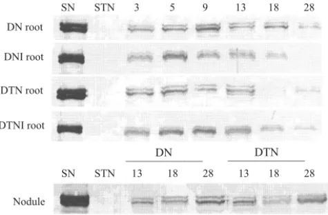 Figure 4. Immunoblotting of lipoxygenases from soybean roots and nodules at different developmental stages
