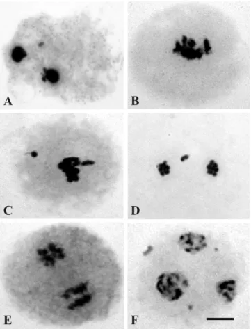 Figure  2.  Meiotic  abnormalities  in  Crotalaria  zanzibarica (n = 8). (A) Condensed nuclei; (B) sticky  chromosomes;  (C)  metaphase  I;  and  (D)  prophase  II  with laggard or lost chromosomes; (E) irregular meiotic  spindle; (F) triad with micronucle