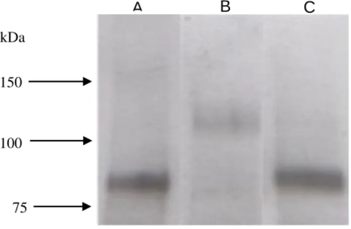 Figure 6 Western blot of T24 (A), 5637 (B) and HT1376 (C) presenting the most intense band for CD44