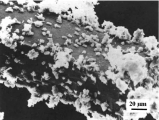 Figura 5. (A) Imagem de microscopia eletrônica de varredura da zeólita MWW  sintetizada em 25 dias e utilizada como macro semente e em (B) visualização  deste grão de semente que originou cristais menores de MWW após período de  4 dias de reação com uma so