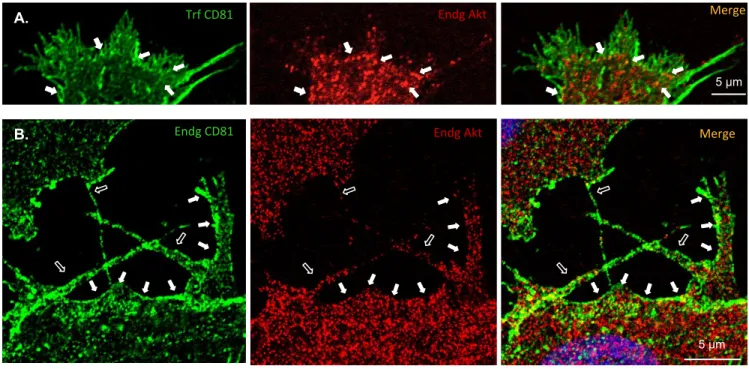 Figure   2.   Co-­‐localiza@on   between   CD81   and   AKT1.   Confocal   microscopy   analysis   of   the   subcellular   co-­‐localizaGon   of    CD81   (in   green),   either   exogenous   (A.,   transfected   cells)   or   endogenous   (B.,   parental