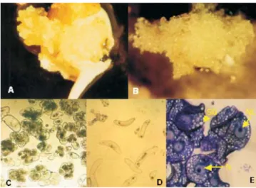 Figure 1. Callus types and cell suspension of banana cv.