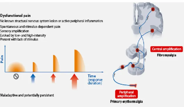 Fig. 4: Dysfunctional pain. 
