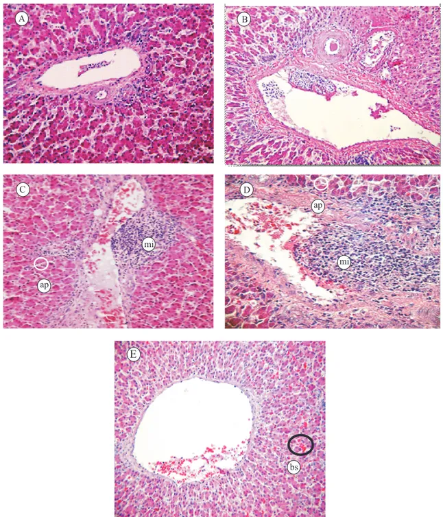 Figure  1.  Sections  of  hepatic  tissue  of  chicken  broiler  fed  diets  supplemented  with  different  concentrations  of  piperine,  stained with haematoxylin and eosin, and examined by an optical microscope (Olympus CH30), at 200 x, coupled with a  