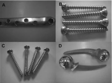 Figura 1. Implantes removidos cirurgicamente de pacientes