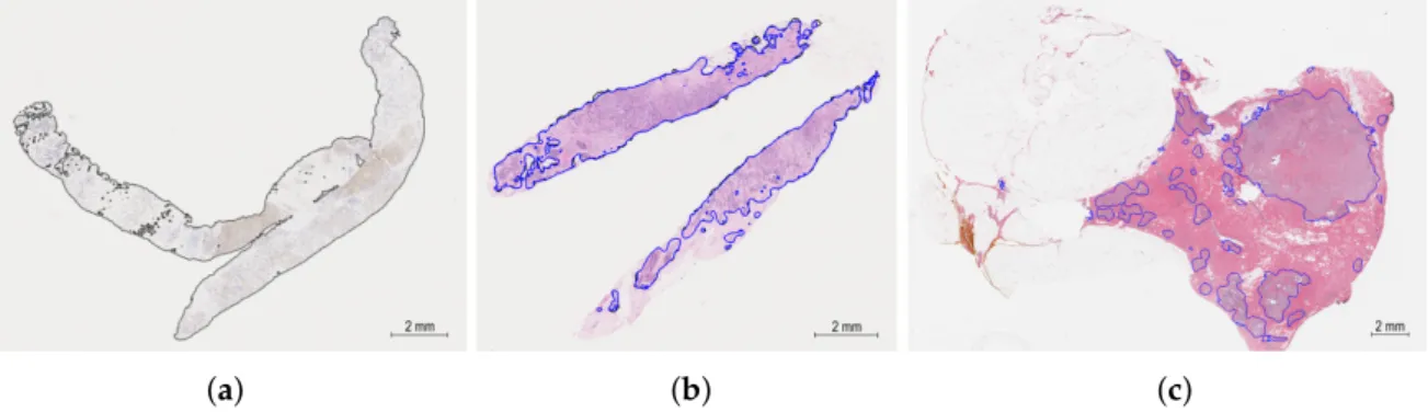 Figure 2. Image examples from used datasets: HER2SC [10] IHC stained slides (a), HER2SC [10] H&amp;E stained slides (b), BRCA [11,12] H&amp;E stained slides (c)