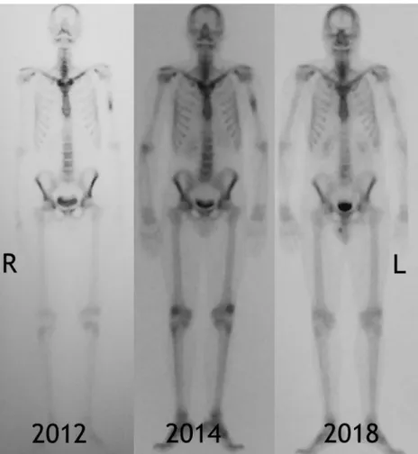 Fig. 2 Sequential bone scintigraphy: Initial bone scintigraphy images were obtained 2 h after radiolabelled injection