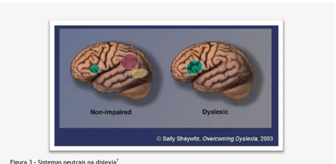 Figura 3 – Sistemas neutrais na dislexia 7