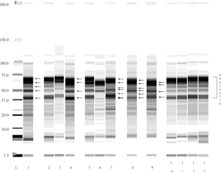 Figure 1. Biochemical characterization of the common bean (Phaseolus vulgaris) germplasm from the Island of Madeira,  using the lab-on-a-chip technique