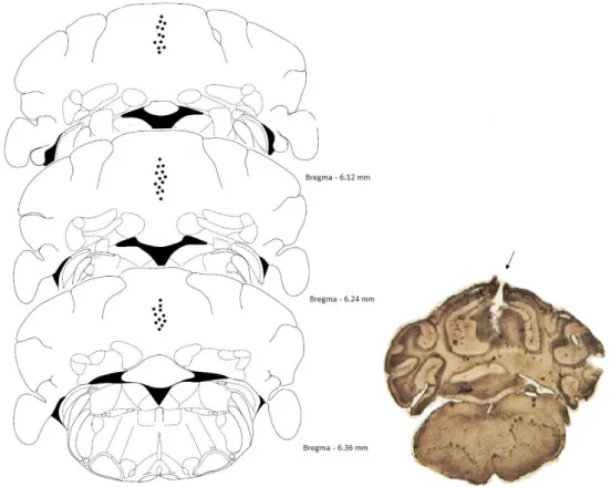 Figura 5: Figuras adaptadas do atlas de Paxinos e Franklin (2001), implantação da cânula guia e fotomicrografia  do cerebelo de camundongo mostrando trajeto da cânula no vérmis cerebelar.