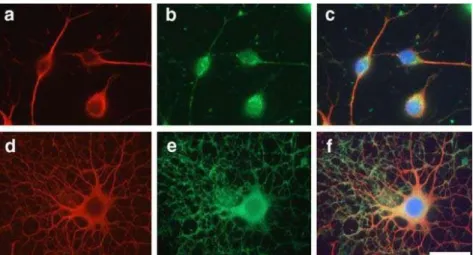 Figure  5.  Immunocytochemical  localization  of  microtubules  and  M BP during OL  differentiation