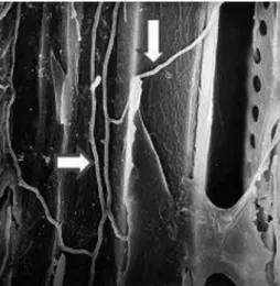 Figura 3. Microscopia eletrônica de varredura mostrando hifas de Ganoderma  australe (indicadas por setas) no interior do lúmem de células de Nothofagus  dombeyi