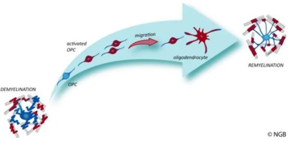 Figure  I.4  -  The  remyelination  process.  In  demyelinating  events,  the  myelin  sheath  or  the  oligodendrocytes are lost