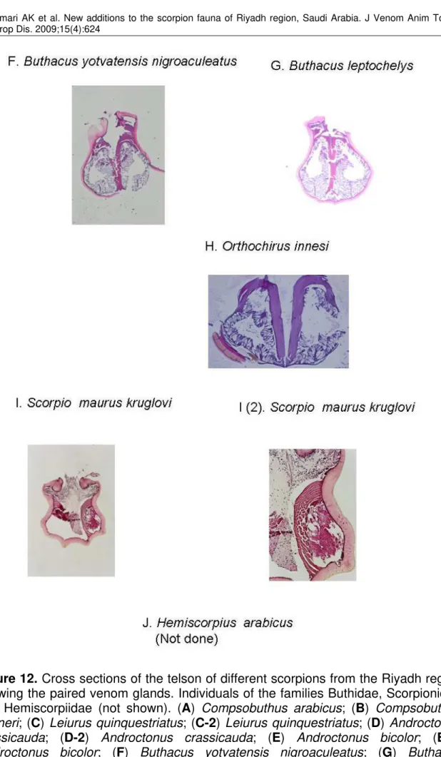 Figure 12. Cross sections of the telson of different scorpions from the Riyadh region  showing the paired venom glands