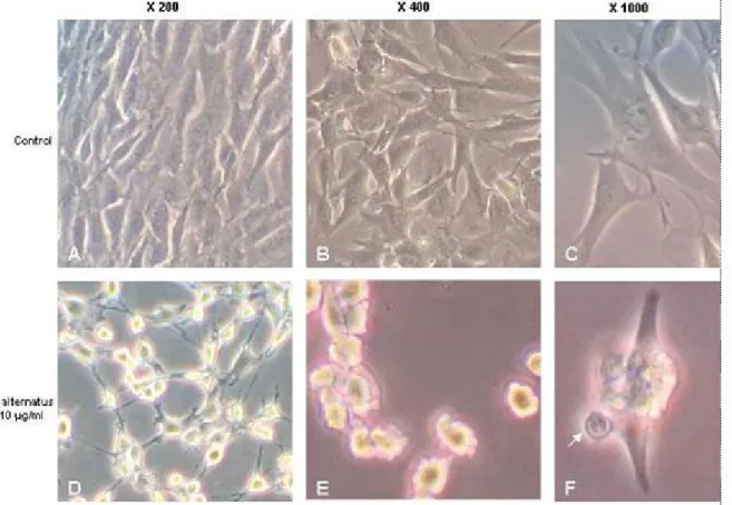 Figure 2. Morphological characterization under phase contrast microscopy of cell  death induced by B