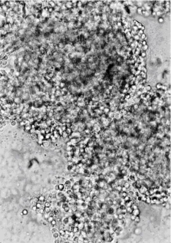 Figure  2.  Photograph  of  agglutinated  mouse  lymphocytes  induced  by  acutolysin  C  (40x)