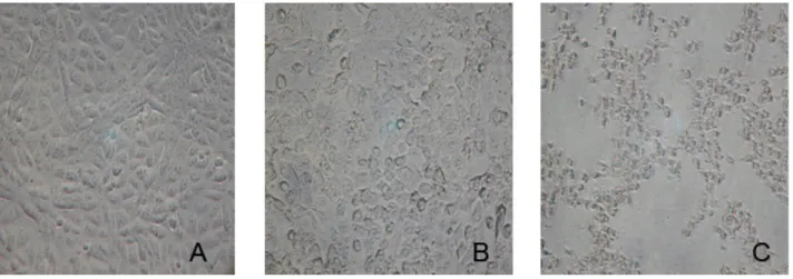 Figure 1. Vero cells under effects of ultrafiltrated (PM 10 membrane) E. coli culture supernatants compared  to (A) control, (B) after 12 hours and (C) 24 hours