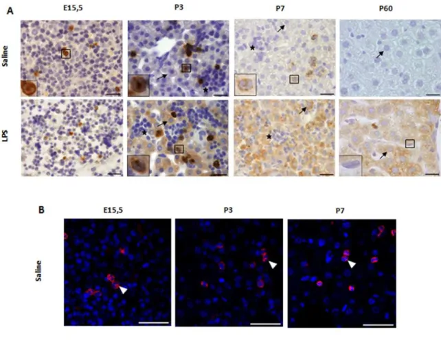 Figure  5    Identification  of  LCN2  expressing  cells  in  the  liver  of  control  and  LPS  injected  mice