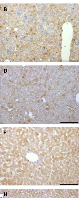 Figure 6  Immunodetection of LCN2 in the liver of post natal animals that were injected with saline or LPS