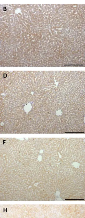 Figure  7    Immunodetection  of  LCN2  in  the  liver  of  adult  animals  that  were  injected  with  saline  or  LPS